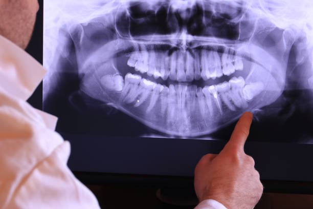 Best Emergency Root Canal Treatment in Madison, GA