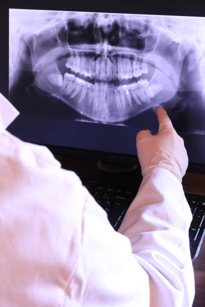 Best Emergency Broken Tooth Repair in Madison, GA
